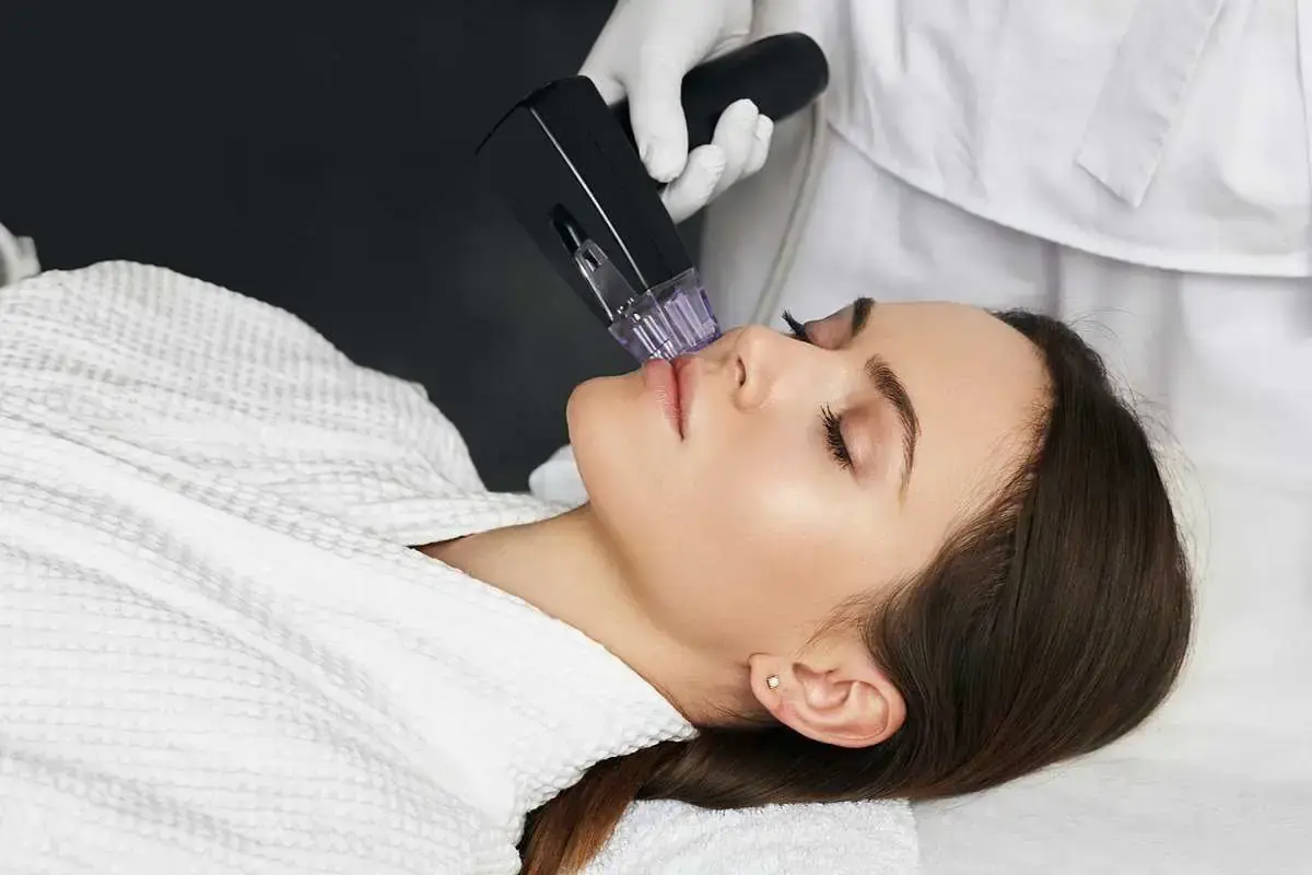 Clinician performing Morpheus8 microneedling treatment on patient's face in Fort Lee, NJ